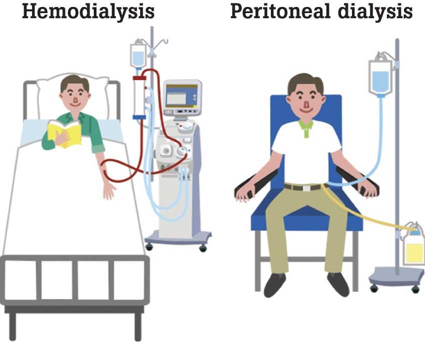 Daily Mirror Understanding dialysis solutions